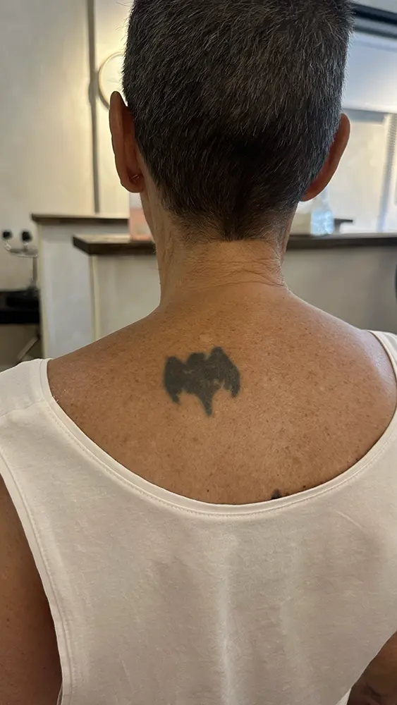 Tatuaje original de murciélago de bacardi en la espalda, con muchos años que ha perdido definición y se ha expandido